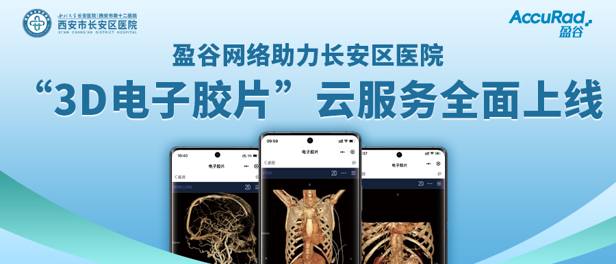 盈谷網(wǎng)絡(luò )助力長(cháng)安區醫院“3D電子膠片”云服務(wù)全面上線(xiàn)！診斷結果、影像資料隨時(shí)隨地看！